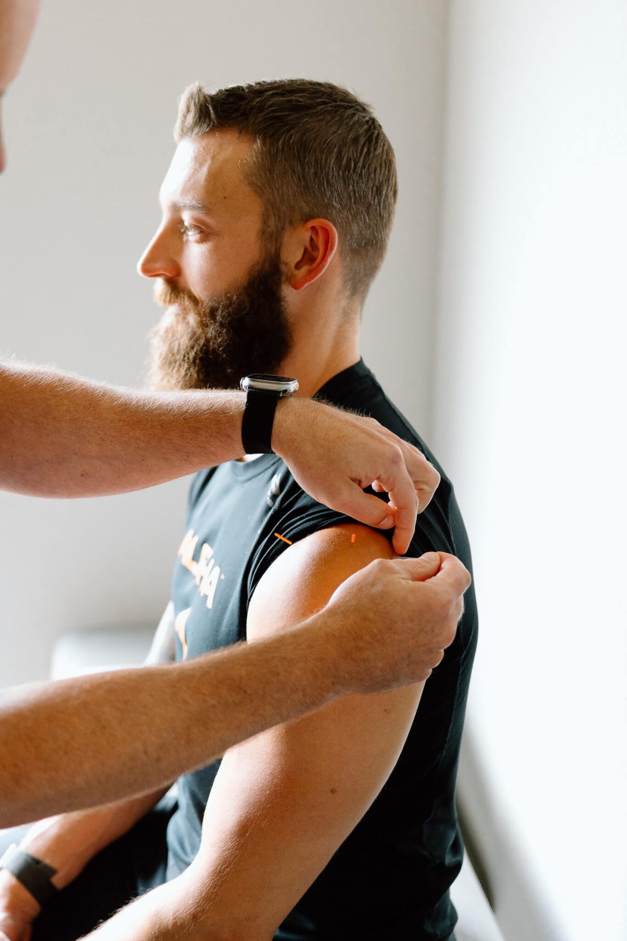 Lenexa acupuncture treatment session at Meylor Chiropractic for stress and pain management